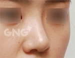 GNG Hospital, Reviews, Images, Promotions — Korea cost, reviews & before-after | MISOODA