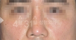 April 31 Plastic Surgery,Reviews,Images,Promotions — Korea cost, reviews & before-after | MISOODA