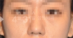 April 31 Plastic Surgery,Reviews,Images,Promotions — Korea cost, reviews & before-after | MISOODA