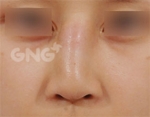 GNG Hospital, Reviews, Images, Promotions — Korea cost, reviews & before-after | MISOODA