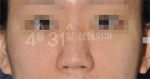 April 31 Plastic Surgery,Reviews,Images,Promotions — Korea cost, reviews & before-after | MISOODA