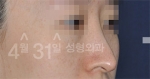 April 31 Plastic Surgery,Reviews,Images,Promotions — Korea cost, reviews & before-after | MISOODA
