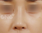GNG Hospital, Reviews, Images, Promotions — Korea cost, reviews & before-after | MISOODA