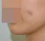 GIRIN Plastic Surgery. GIRIN aesthetic Clinic — Korea cost, reviews & before-after | MISOODA