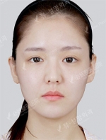 View Plastic Surgery, Reviews, Images, Promotions — Korea cost, reviews & before-after | MISOODA
