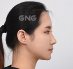 GNG Hospital, Reviews, Images, Promotions — Korea cost, reviews & before-after | MISOODA