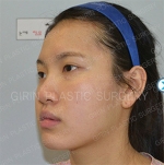 GIRIN Plastic Surgery. GIRIN aesthetic Clinic — Korea cost, reviews & before-after | MISOODA