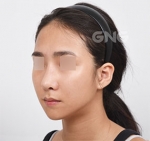 GNG Hospital, Reviews, Images, Promotions — Korea cost, reviews & before-after | MISOODA