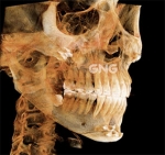 GNG Hospital, Reviews, Images, Promotions — Korea cost, reviews & before-after | MISOODA