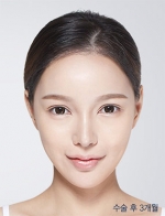 DA Plastic Surgery, Reviews, Images, Promotions — Korea cost, reviews & before-after | MISOODA