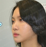 GIRIN Plastic Surgery. GIRIN aesthetic Clinic — Korea cost, reviews & before-after | MISOODA