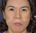 April 31 Plastic Surgery,Reviews,Images,Promotions — Korea cost, reviews & before-after | MISOODA