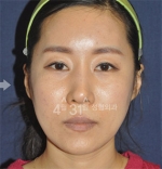 April 31 Plastic Surgery,Reviews,Images,Promotions — Korea cost, reviews & before-after | MISOODA