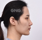 GNG Hospital, Reviews, Images, Promotions — Korea cost, reviews & before-after | MISOODA