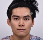 GNG Hospital, Reviews, Images, Promotions — Korea cost, reviews & before-after | MISOODA