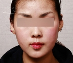Theline Plastic Surgery,Reviews,Images, Promotions — Korea cost, reviews & before-after | MISOODA