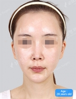 View Plastic Surgery, Reviews, Images, Promotions — Korea cost, reviews & before-after | MISOODA