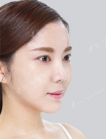 View Plastic Surgery, Reviews, Images, Promotions — Korea cost, reviews & before-after | MISOODA