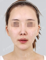 View Plastic Surgery, Reviews, Images, Promotions — Korea cost, reviews & before-after | MISOODA