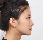 GNG Hospital, Reviews, Images, Promotions — Korea cost, reviews & before-after | MISOODA