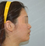 GIRIN Plastic Surgery. GIRIN aesthetic Clinic — Korea cost, reviews & before-after | MISOODA