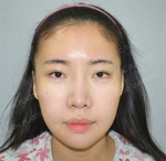 GIRIN Plastic Surgery. GIRIN aesthetic Clinic — Korea cost, reviews & before-after | MISOODA