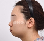GNG Hospital, Reviews, Images, Promotions — Korea cost, reviews & before-after | MISOODA