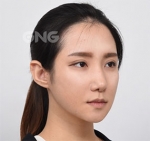 GNG Hospital, Reviews, Images, Promotions — Korea cost, reviews & before-after | MISOODA