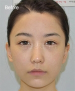 GIRIN Plastic Surgery. GIRIN aesthetic Clinic — Korea cost, reviews & before-after | MISOODA