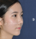April 31 Plastic Surgery,Reviews,Images,Promotions — Korea cost, reviews & before-after | MISOODA