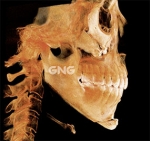 GNG Hospital, Reviews, Images, Promotions — Korea cost, reviews & before-after | MISOODA