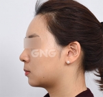 GNG Hospital, Reviews, Images, Promotions — Korea cost, reviews & before-after | MISOODA