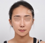 GNG Hospital, Reviews, Images, Promotions — Korea cost, reviews & before-after | MISOODA