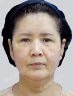View Plastic Surgery, Reviews, Images, Promotions — Korea cost, reviews & before-after | MISOODA