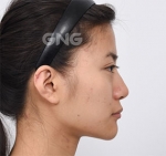 GNG Hospital, Reviews, Images, Promotions — Korea cost, reviews & before-after | MISOODA