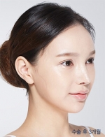 DA Plastic Surgery, Reviews, Images, Promotions — Korea cost, reviews & before-after | MISOODA