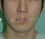 April 31 Plastic Surgery,Reviews,Images,Promotions — Korea cost, reviews & before-after | MISOODA