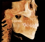 GNG Hospital, Reviews, Images, Promotions — Korea cost, reviews & before-after | MISOODA