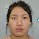 GIRIN Plastic Surgery. GIRIN aesthetic Clinic — Korea cost, reviews & before-after | MISOODA