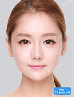 View Plastic Surgery, Reviews, Images, Promotions — Korea cost, reviews & before-after | MISOODA