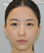 GIRIN Plastic Surgery. GIRIN aesthetic Clinic — Korea cost, reviews & before-after | MISOODA