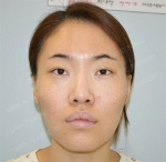 GIRIN Plastic Surgery. GIRIN aesthetic Clinic — Korea cost, reviews & before-after | MISOODA