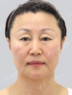 View Plastic Surgery, Reviews, Images, Promotions — Korea cost, reviews & before-after | MISOODA