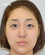 GIRIN Plastic Surgery. GIRIN aesthetic Clinic — Korea cost, reviews & before-after | MISOODA