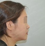 GIRIN Plastic Surgery. GIRIN aesthetic Clinic — Korea cost, reviews & before-after | MISOODA