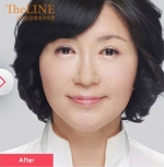 Theline Plastic Surgery,Reviews,Images, Promotions — Korea cost, reviews & before-after | MISOODA