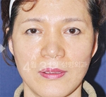 April 31 Plastic Surgery,Reviews,Images,Promotions — Korea cost, reviews & before-after | MISOODA