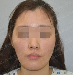 GIRIN Plastic Surgery. GIRIN aesthetic Clinic — Korea cost, reviews & before-after | MISOODA