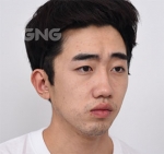 GNG Hospital, Reviews, Images, Promotions — Korea cost, reviews & before-after | MISOODA