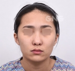 GNG Hospital, Reviews, Images, Promotions — Korea cost, reviews & before-after | MISOODA